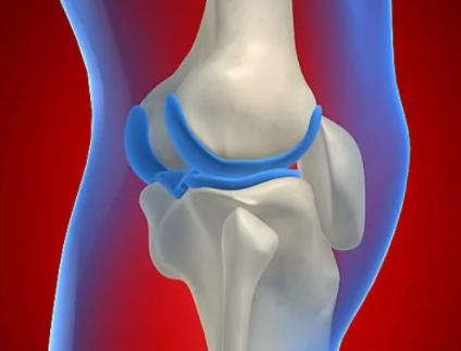 Повреждение мениска коленного сустава: диагностика и лечение