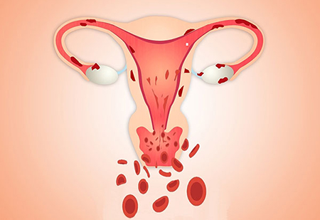Менструации нет, а красные пятна есть! Кровотечение после секса: причины возникновения и что делать